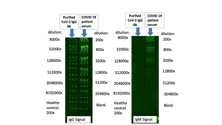 Nirmdas Has Developed High-Accuracy pGOLD™ Microarray Based High Throughput ELISA-like COVID-19 IgG/IgM/IgA Assay for Research Use Only