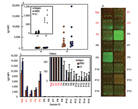 1640241480924289.jpg Nirmidas pGOLD microarray assay detects antibodies in human saliva from infection and vaccines of COVID-19