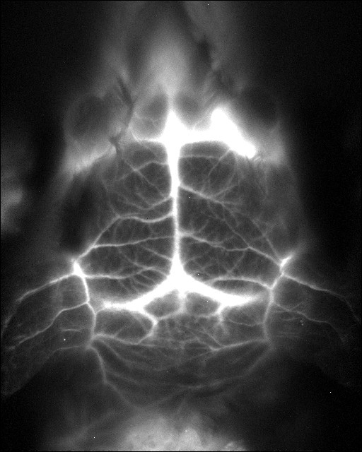 image of mouse brain vasculatures using quantum dots by the group of professor Hongjie Dai, Stanford University