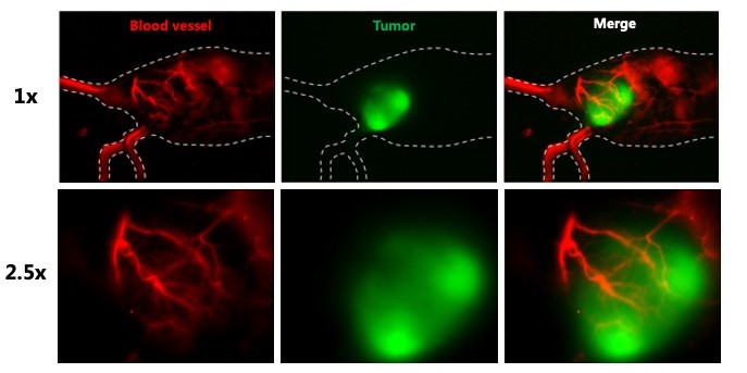 Example of KingsVision image:rare-earth down-conversion nanoparticles dye/luc2 to study 4T1-luc tumor and mouse blood vessle 